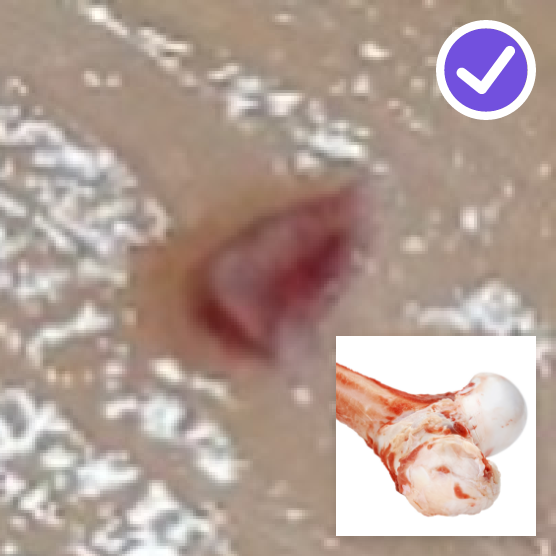 Bone